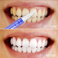 Load image into Gallery viewer, Putimi Gel Teeth Whitening Pen Dental Teeth Whitening
